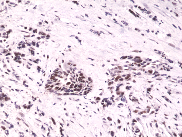 Immunohistochemical