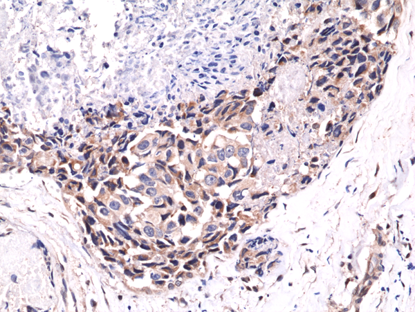 Immunohistochemical