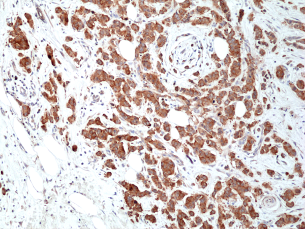 Immunohistochemical