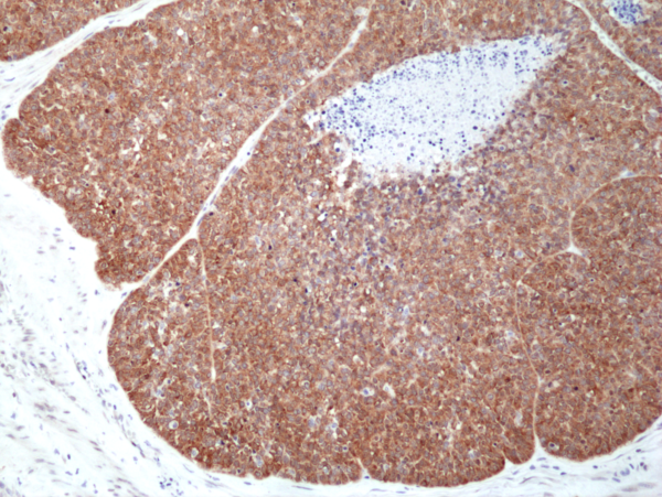 Immunohistochemical