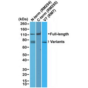 Anti-Androgen Receptor (C-term) Rabbit Monoclonal Antibody [Clone RM255], 31-1136-00 - Image 3