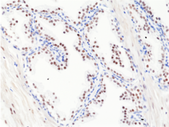 C Terminal & N Terminal Androgen Receptor