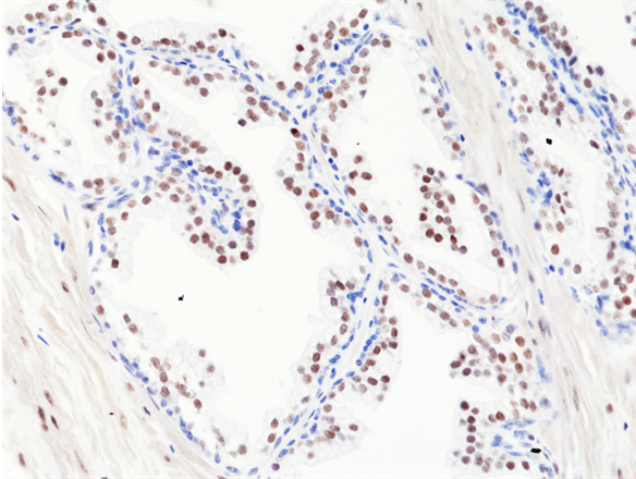 Immunohistochemical