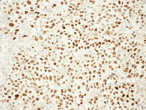 Anti-Androgen Receptor (C-term) Rabbit Monoclonal Antibody [Clone RM255], 31-1136-00 - Image 2