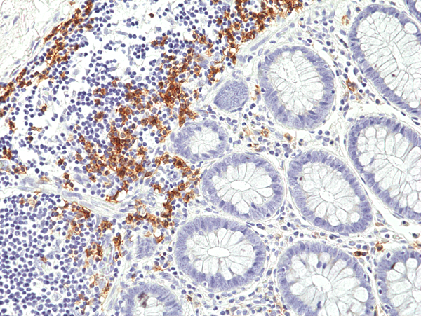 Immunohistochemical