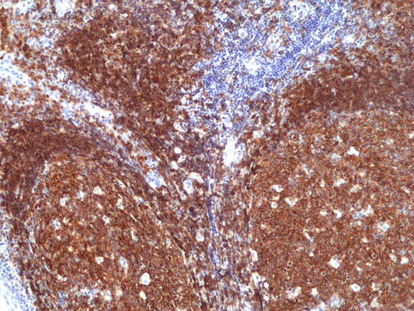 Immunohistochemical