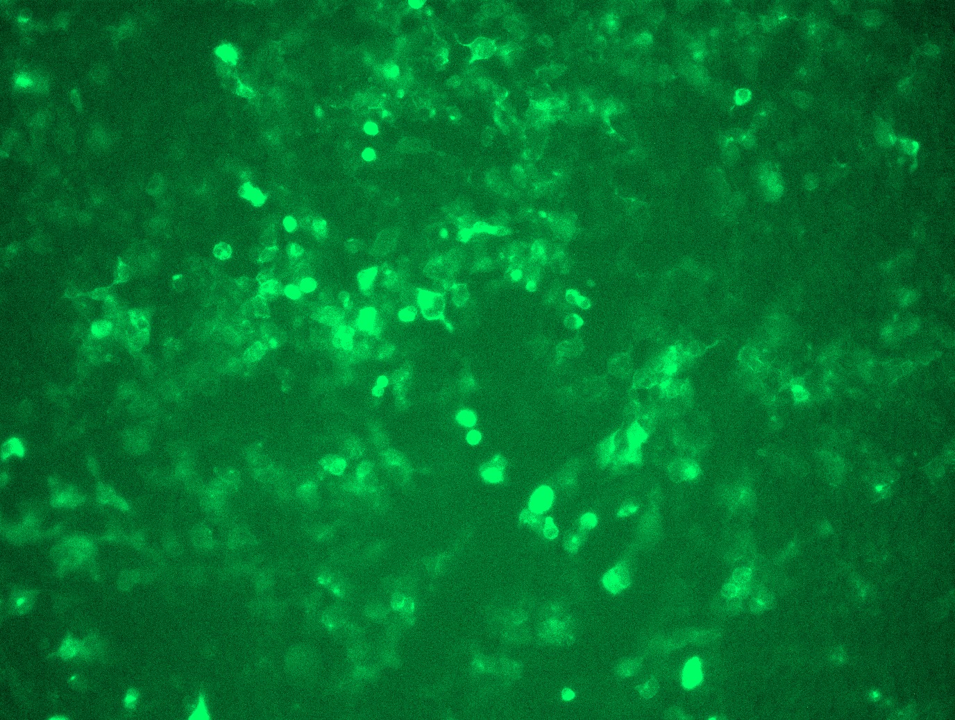 BMPR2 (NM_001204) Human Tagged ORF Clone Lentiviral Particle