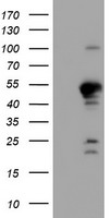 GADD34 (PPP1R15A) Mouse Monoclonal Antibody (HRP conjugated) [Clone ID: OTI4F1]