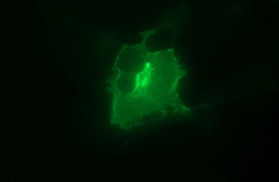 EPCAM Mouse Monoclonal Antibody [Clone ID: OTI1H9]