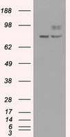 Melanoma gp100 (PMEL) Mouse Monoclonal Antibody [Clone ID: OTI10E5]