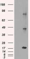 NY-ESO-1 (CTAG1B) Mouse Monoclonal Antibody [Clone ID: OTI3C9]