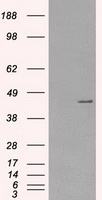 Protein Kinase A regulatory subunit I alpha (PRKAR1A) Mouse Monoclonal Antibody (HRP conjugated) [Clone ID: OTI6C7]