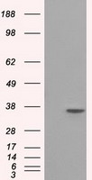 Serine racemase (SRR) Mouse Monoclonal Antibody [Clone ID: OTI2E3]