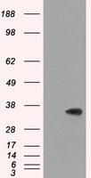 Serine racemase (SRR) Mouse Monoclonal Antibody [Clone ID: OTI1D7]