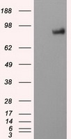 PTP epsilon (PTPRE) Mouse Monoclonal Antibody [Clone ID: OTI5E5]