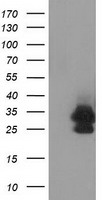 EIF4EL3 (EIF4E2) Mouse Monoclonal Antibody (HRP conjugated) [Clone ID: OTI1F2]