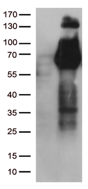 FGFR2 Mouse Monoclonal Antibody [Clone ID: OTI4D6]