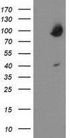 OSBP1 (OSBP) Mouse Monoclonal Antibody [Clone ID: OTI1F2]