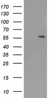 PPAR alpha (PPARA) Mouse Monoclonal Antibody [Clone ID: OTI2G6]