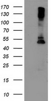 Lipoprotein lipase (LPL) Mouse Monoclonal Antibody [Clone ID: OTI3A10]