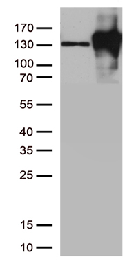 N Cadherin (CDH2) Mouse Monoclonal Antibody (Biotin conjugated) [Clone ID: OTI2G7]