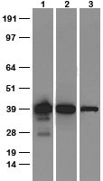 SOX2 Rabbit Monoclonal Antibody [Clone ID: OTIR-2D11]