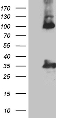 Calretinin (CALB2) Mouse Monoclonal Antibody [Clone ID: OTI1A1]