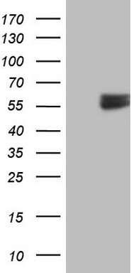 Retinoic Acid Receptor alpha (RARA) Mouse Monoclonal Antibody [Clone ID: OTI2C3]