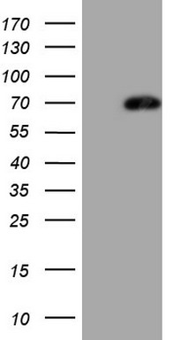 Lymphocyte Activation Gene 3 (LAG3) Mouse Monoclonal Antibody [Clone ID: OTI8F6]