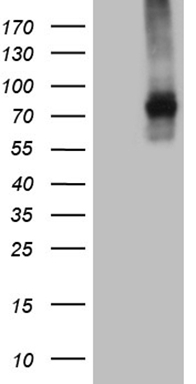 TGF beta Receptor II (TGFBR2) Mouse Monoclonal Antibody [Clone ID: OTI3B4]