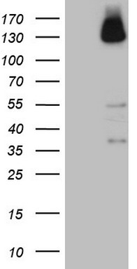 ZNF217 Mouse Monoclonal Antibody [Clone ID: OTI3G5]