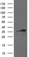 APE1 (APEX1) Mouse Monoclonal Antibody (Biotin conjugated) [Clone ID: OTI2A4]