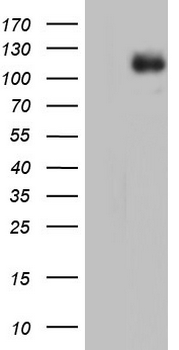 MDA5 (IFIH1) Mouse Monoclonal Antibody [Clone ID: OTI8C10]