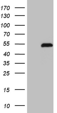 Retinoic Acid Receptor gamma (RARG) Mouse Monoclonal Antibody [Clone ID: OTI3G1]