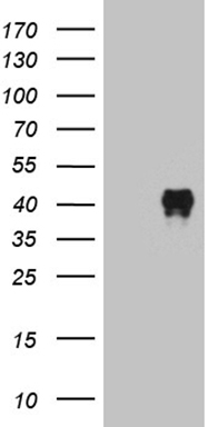 Bone marrow stromal cell antigen 1 (BST1) Mouse Monoclonal Antibody [Clone ID: OTI4E4]