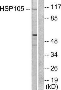 Hsp105 (HSPH1) Rabbit Polyclonal Antibody