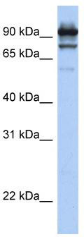 STAT6 Rabbit Polyclonal Antibody