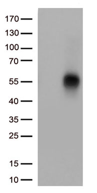 TNFRSF14 Mouse Monoclonal Antibody [Clone ID: OTI5C5]