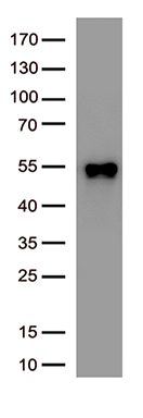 SARS-CoV-2 N Protein Rabbit Polyclonal Antibody