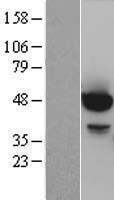 AKT1 (NM_005163) Human Over-expression Lysate