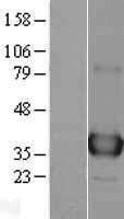 APE1 (APEX1) (NM_001641) Human Over-expression Lysate