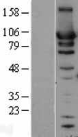 HSP90AB1 (NM_007355) Human Over-expression Lysate