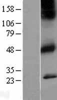 CHRM1 (NM_000738) Human Over-expression Lysate