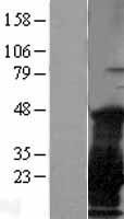 NY-ESO-1 (CTAG1B) (NM_001327) Human Over-expression Lysate