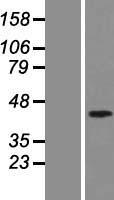 MADH7 (SMAD7) (NM_005904) Human Over-expression Lysate