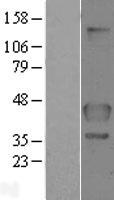 FLCN (NM_144606) Human Over-expression Lysate