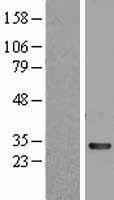 EIF4EL3 (EIF4E2) (NM_004846) Human Over-expression Lysate