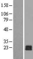 RAC1 (NM_006908) Human Over-expression Lysate