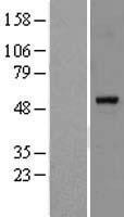 PPAR alpha (PPARA) (NM_005036) Human Over-expression Lysate