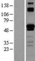 ETV6 (NM_001987) Human Over-expression Lysate